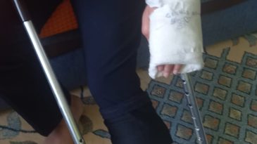 KÖPEK DEHŞET SAÇTI. C.Ü DOKTORLARI, “BİRŞEY YOK”DEDİ.