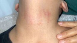 BİTMEYEN İDDİALAR VE CEVAP BEKLEYEN SORULAR